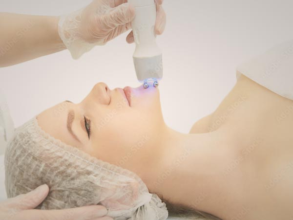 a woman getting a laser treatment