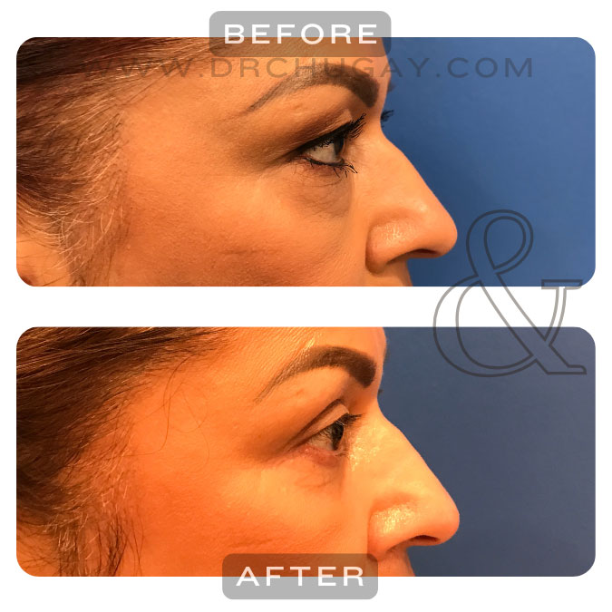 2025-otoño-cirugía-especial-ojo