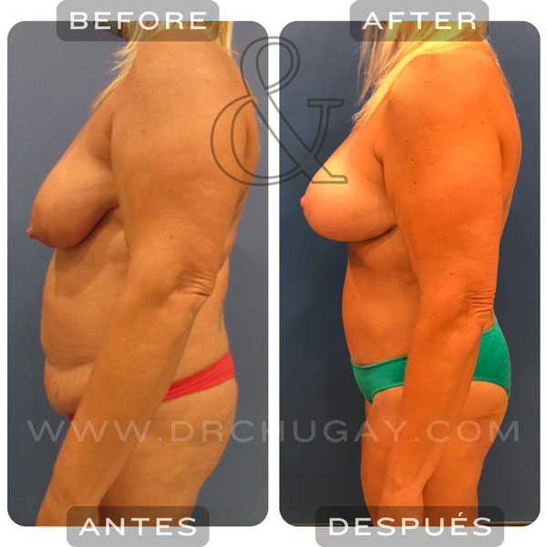 2025-especiales-de-otoño-cambio-de-mamá